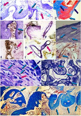 Functionalized Surface Geometries Induce: “Bone: Formation by Autoinduction”